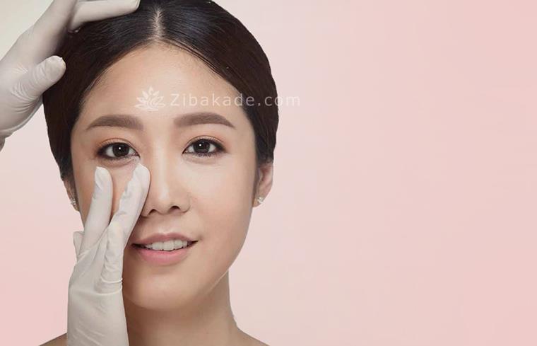 انحراف بینی 